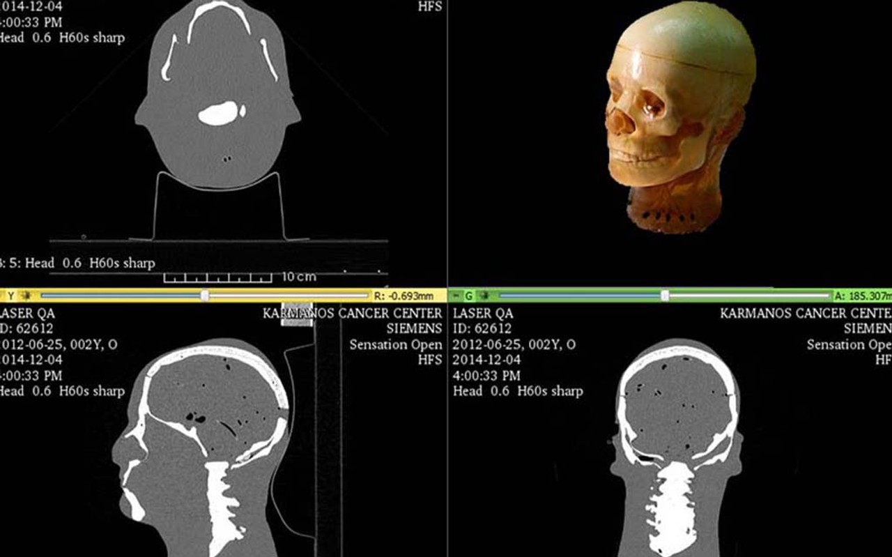 Standard Adult Head Phantom Model - CT Scans