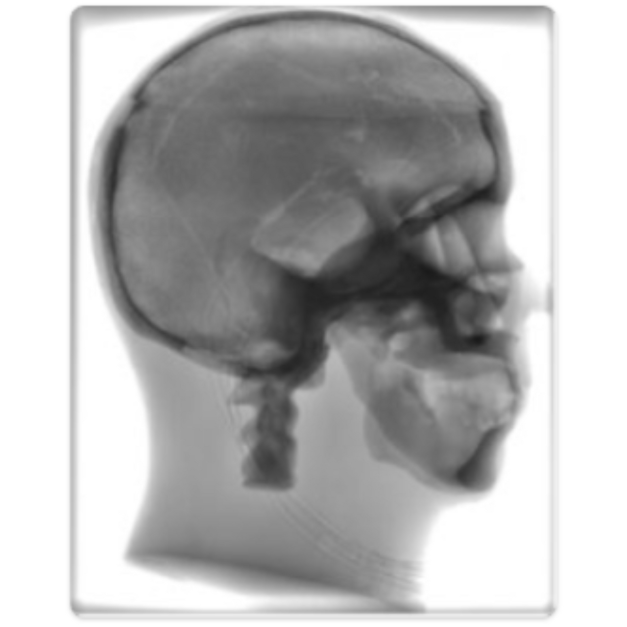 Dynamic Adult Male Head Phantom Model - X-Ray Scans