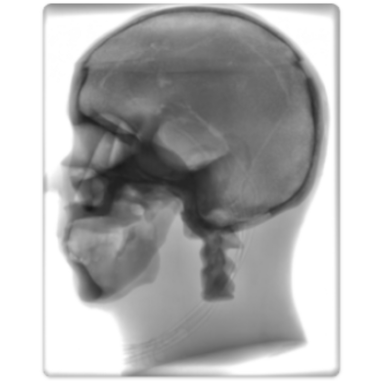 Dynamic Adult Male Head Phantom Model - X-Ray Scans