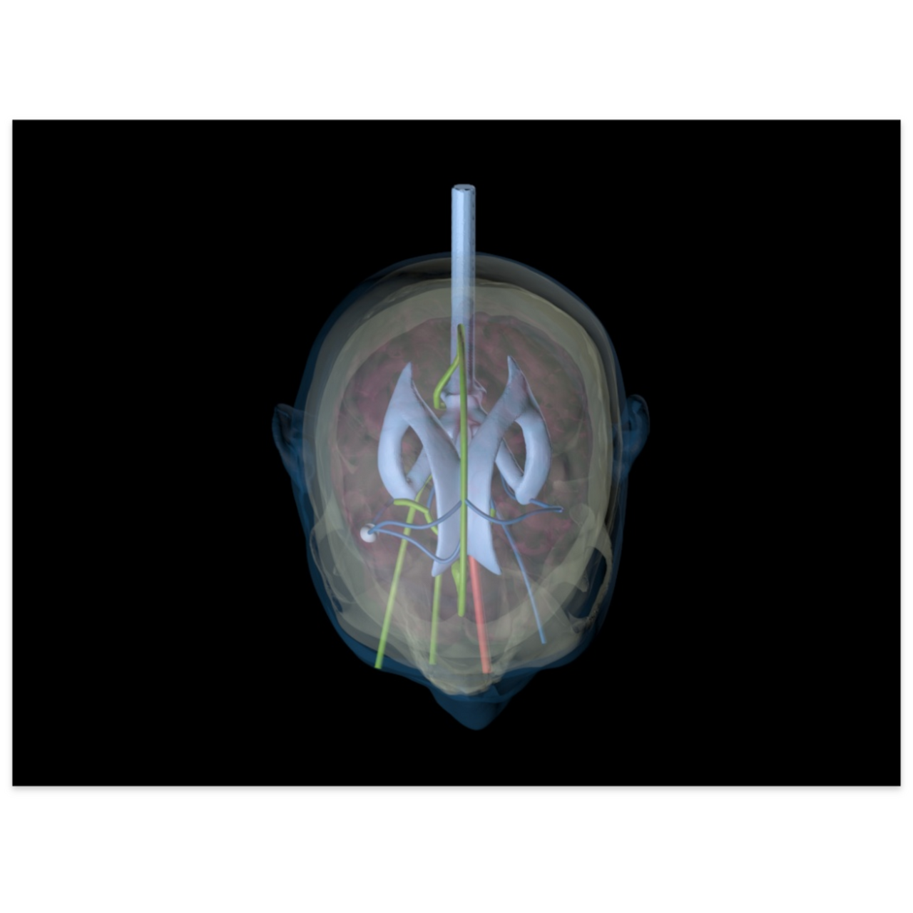 Advanced Dynamic Adult Male Head Phantom Model