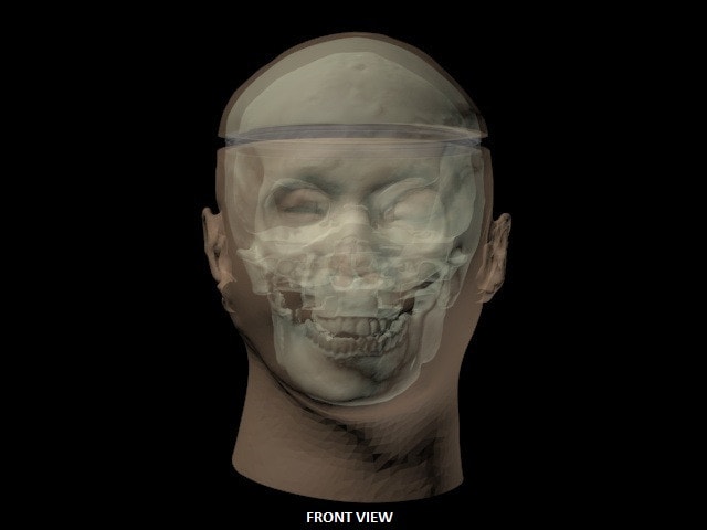 Adult Head (Openable) for X-Ray CT, US, MRI
