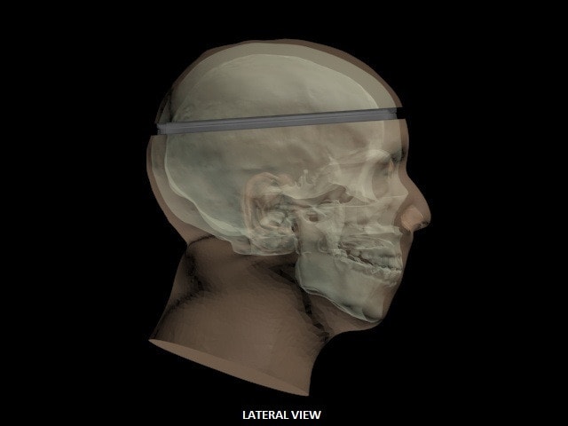 Adult Head (Openable) for X-Ray CT, US, MRI