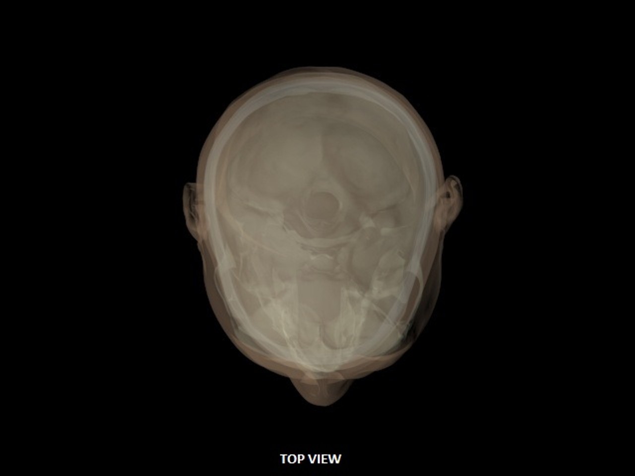 Openable Adult Male Head Phantom - Design