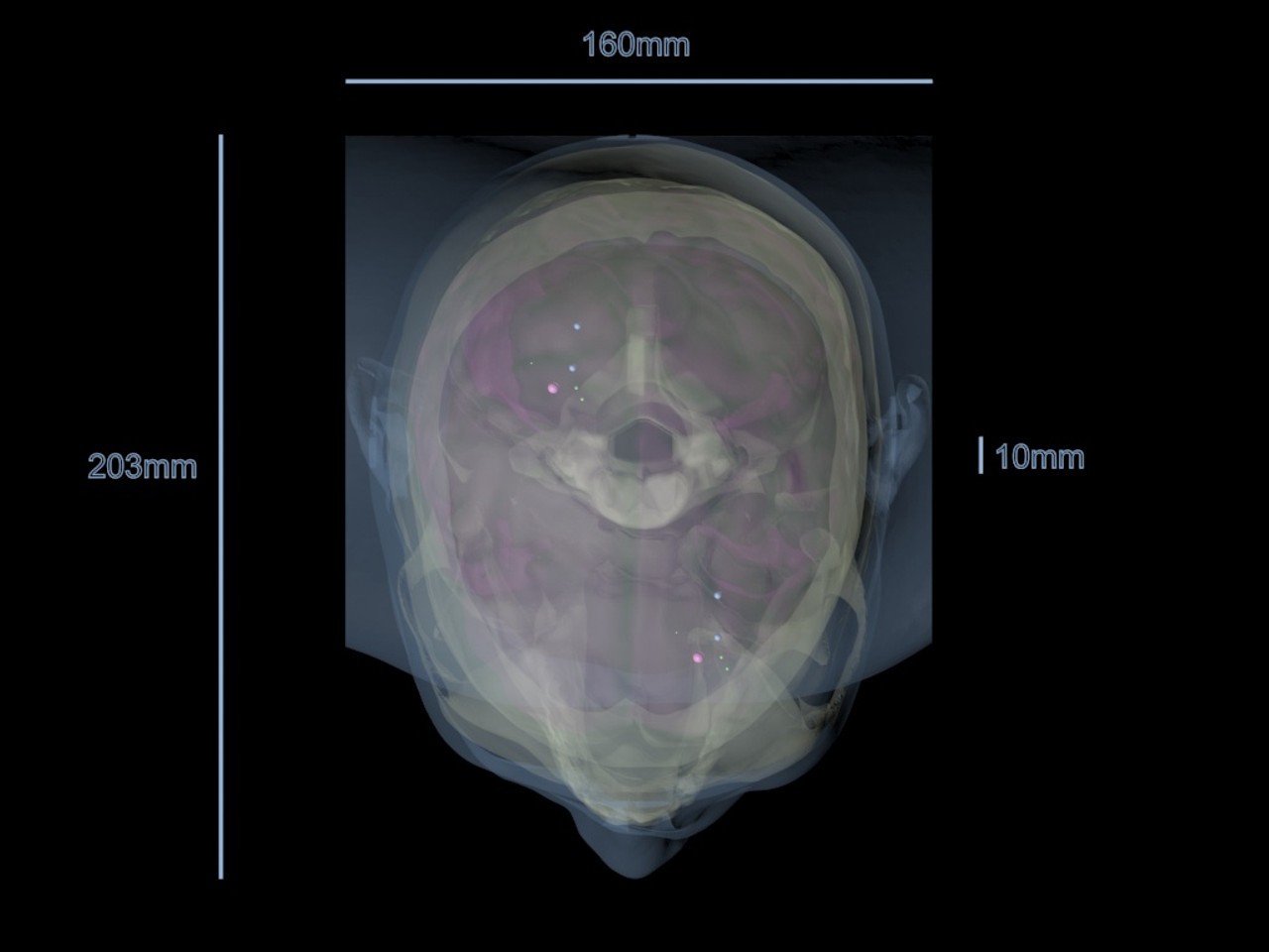 Static Adult Male Head Phantom Model - Design