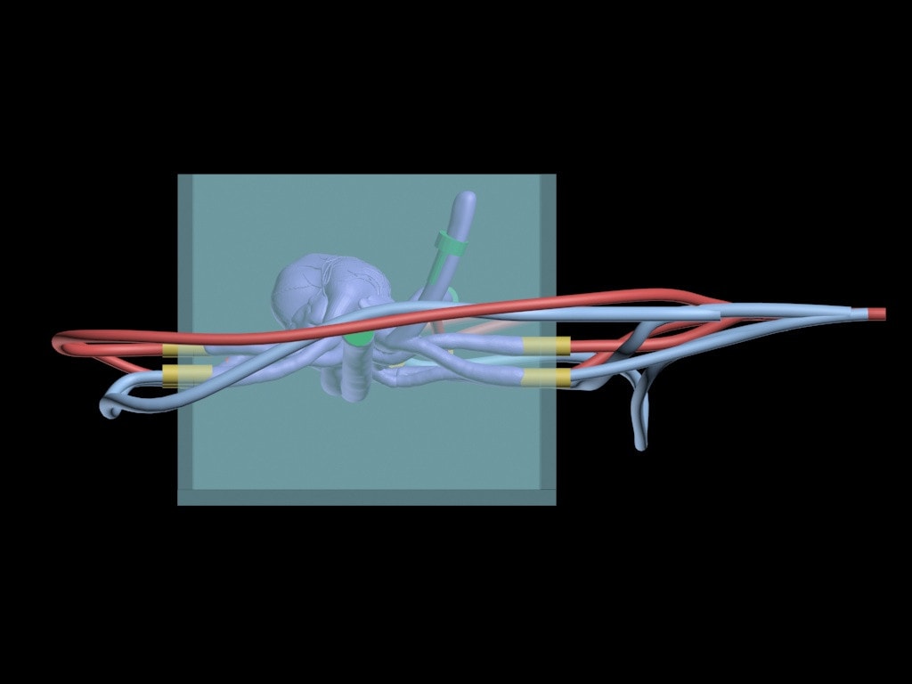 Adult Female Heart for X-Ray CT, US, MRI