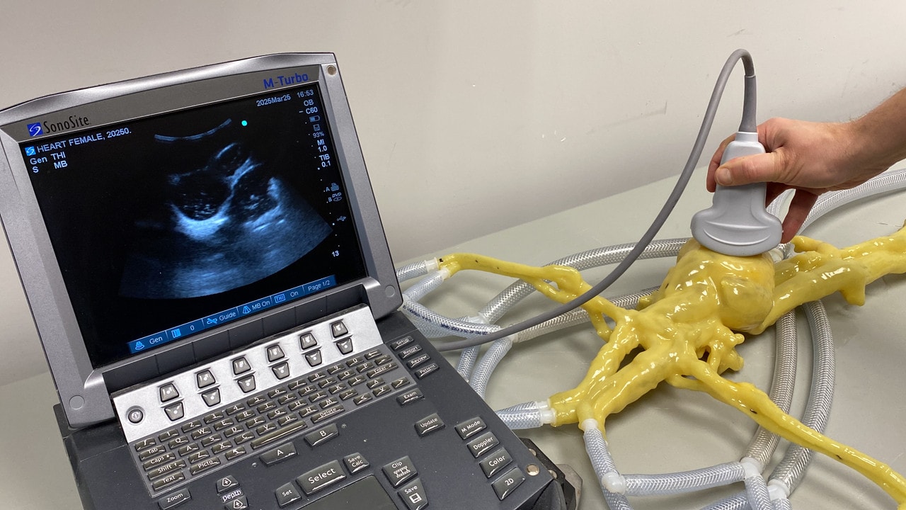 Adult Female Heart for X-Ray CT, US, MRI