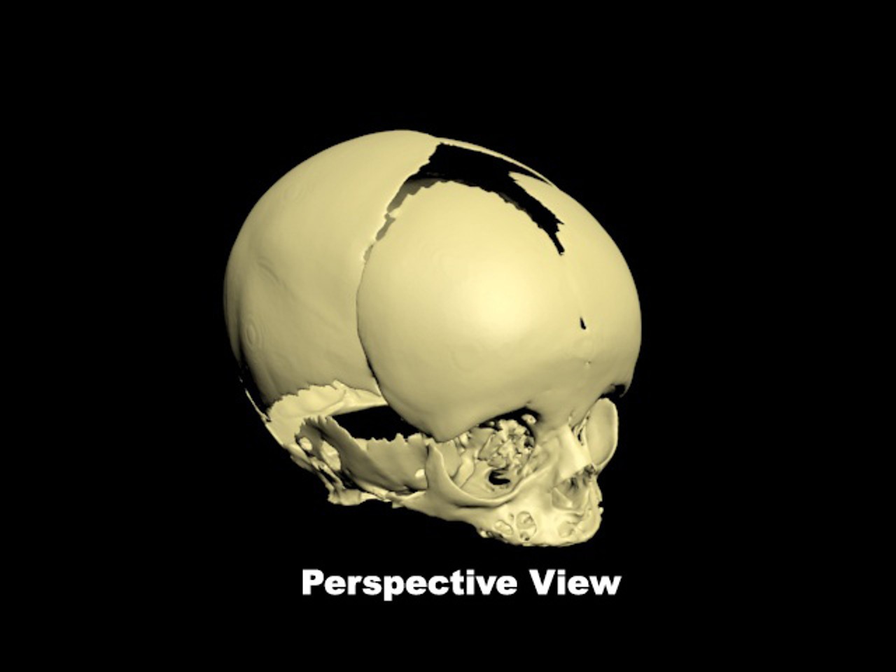 Newborn Baby Skull Phantom Model - Design