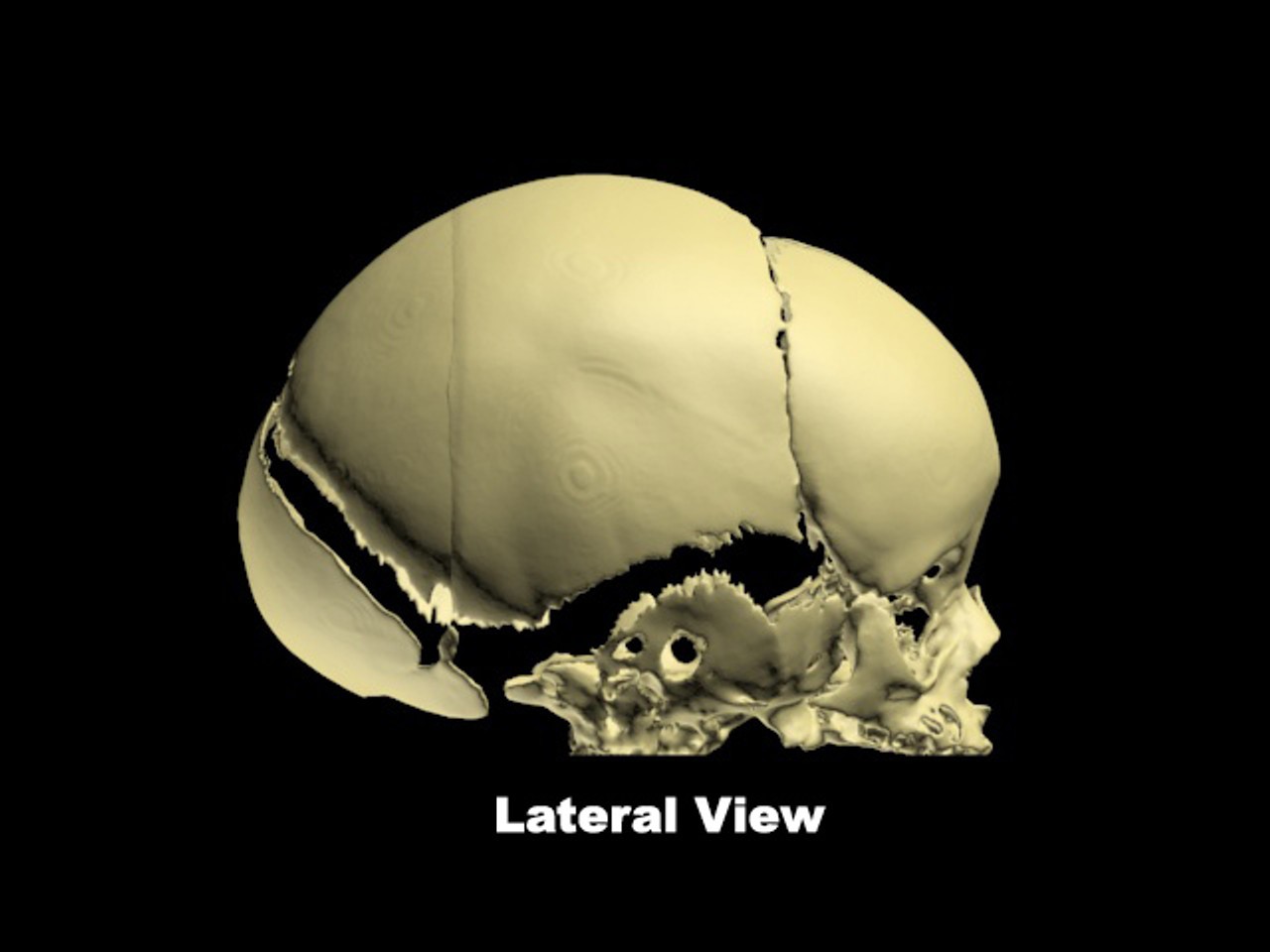 Newborn Baby Skull Phantom Model - Design