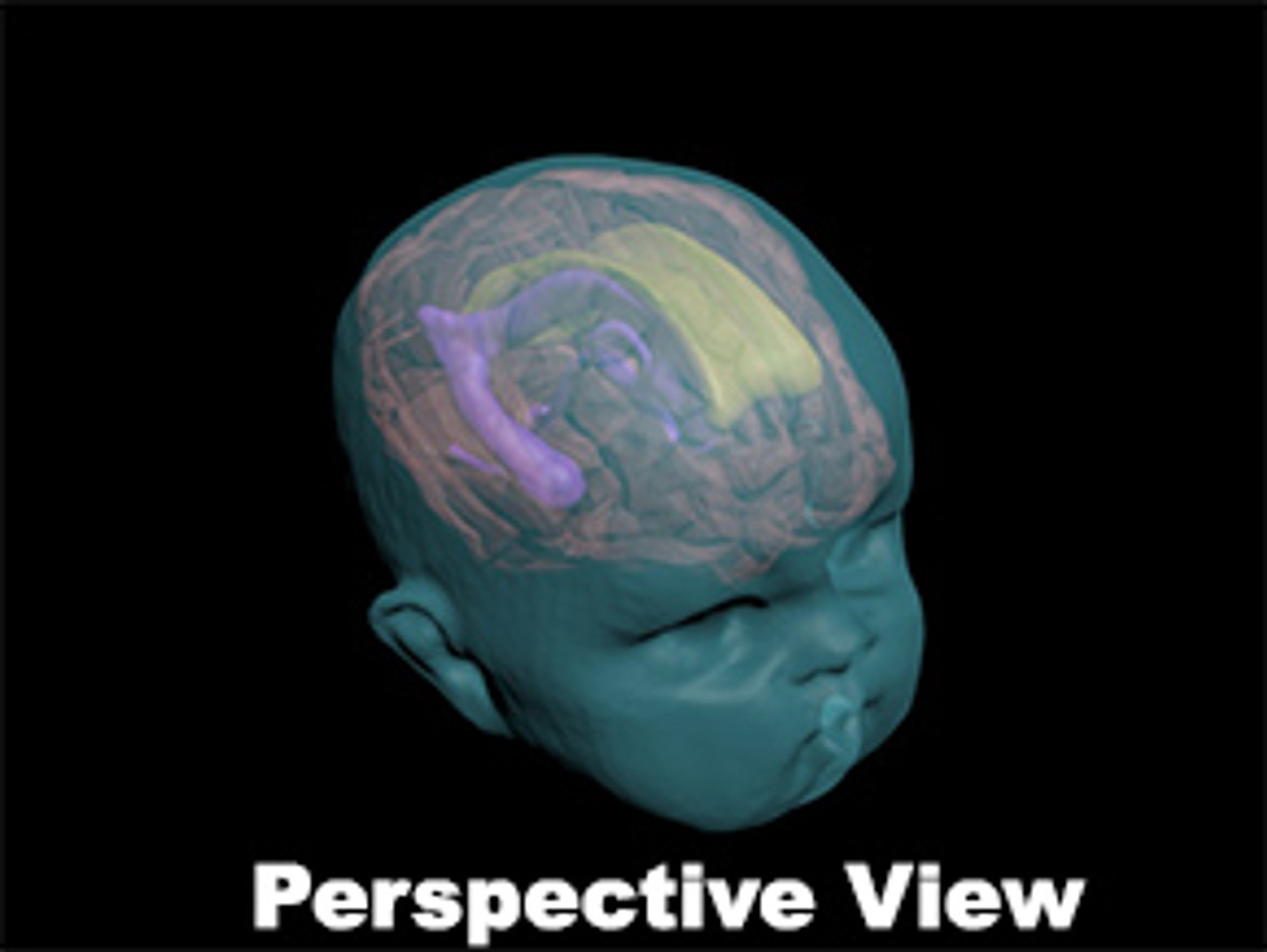 Newborn Baby Complex Head Phantom Model - Design