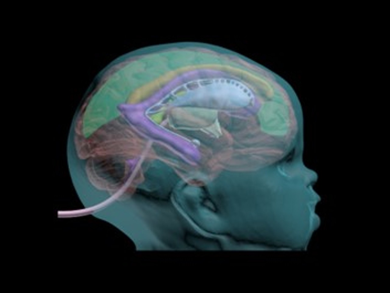 Newborn Baby Complex Head Phantom Model - Design