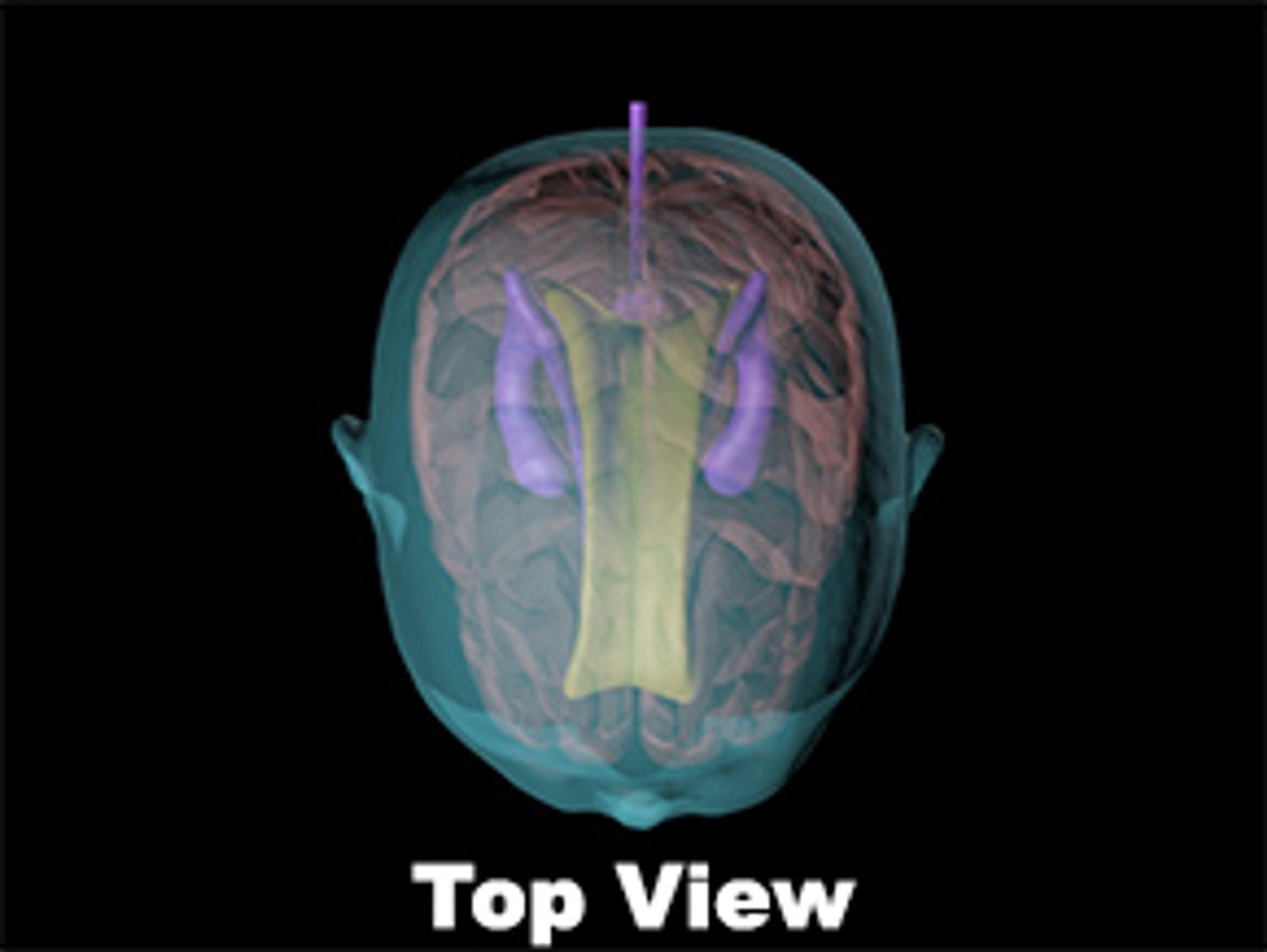 Newborn Baby Simple Head Phantom Model - Design