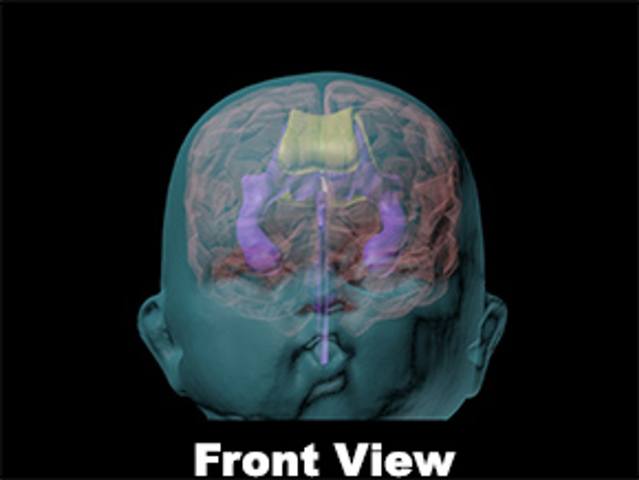 Newborn Baby Simple Head Phantom Model - Design