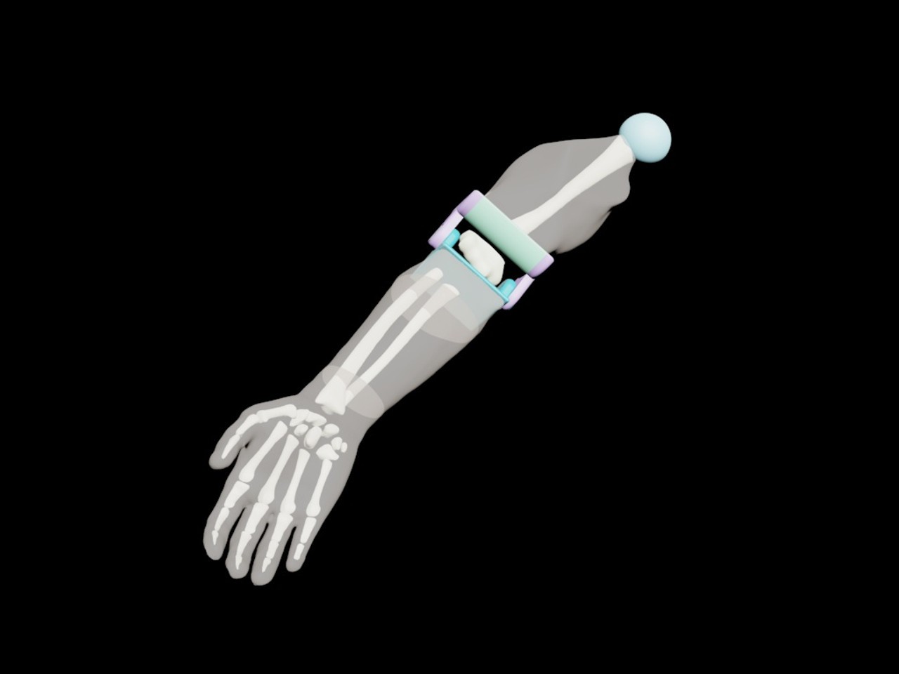 Adult Arm X-Ray Phantom Model - Design