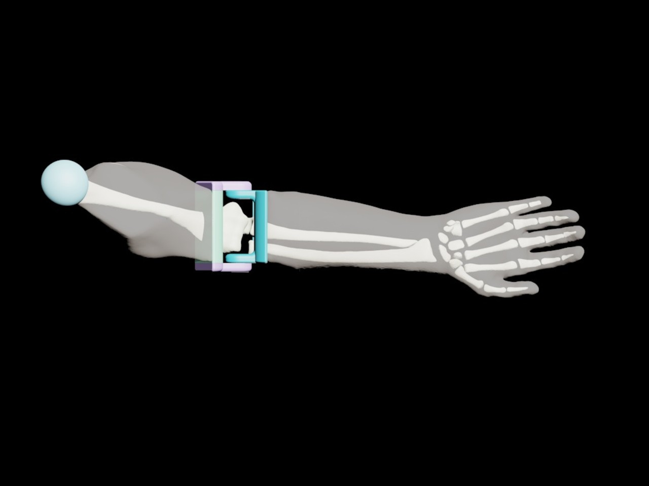 Adult Arm X-Ray Phantom Model - Design