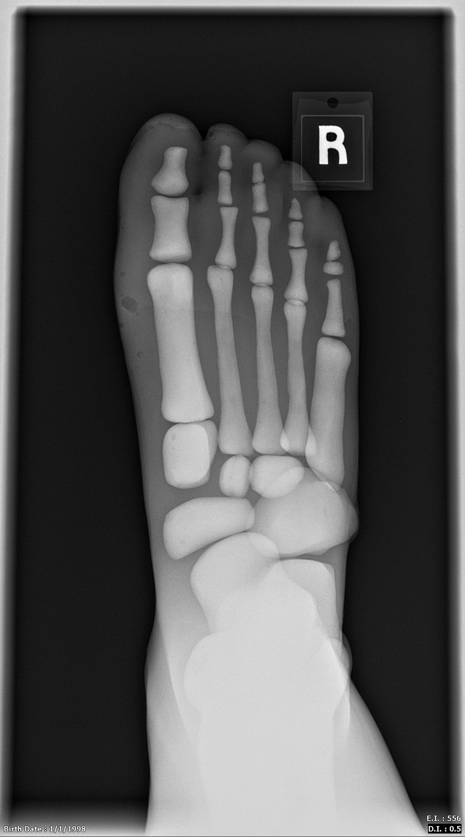 Adult Male Full Body X-Ray/CT and MRI Phantom Model - X-Ray scans