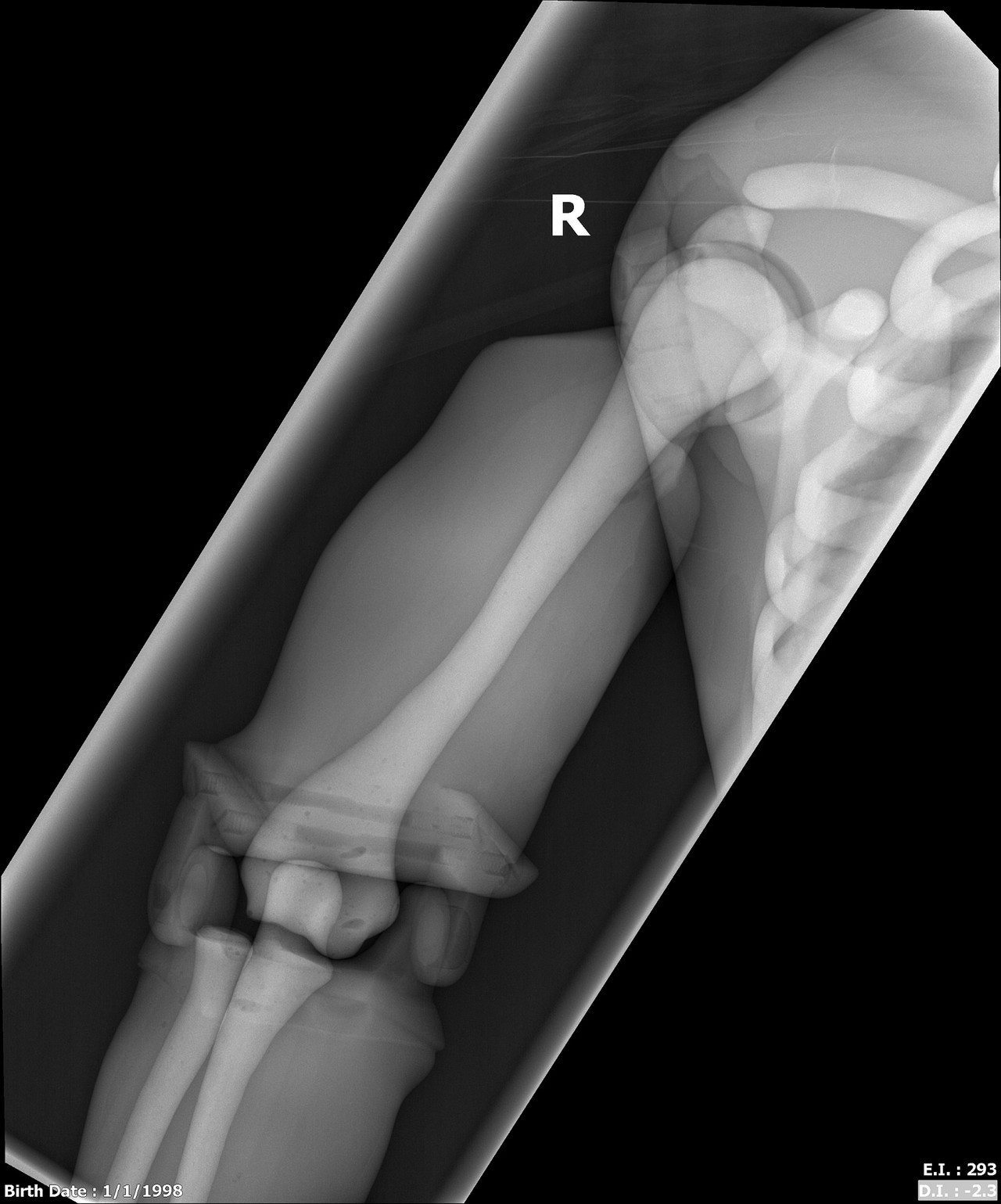 Adult Male Full Body X-Ray/CT and MRI Phantom Model - X-Ray scans