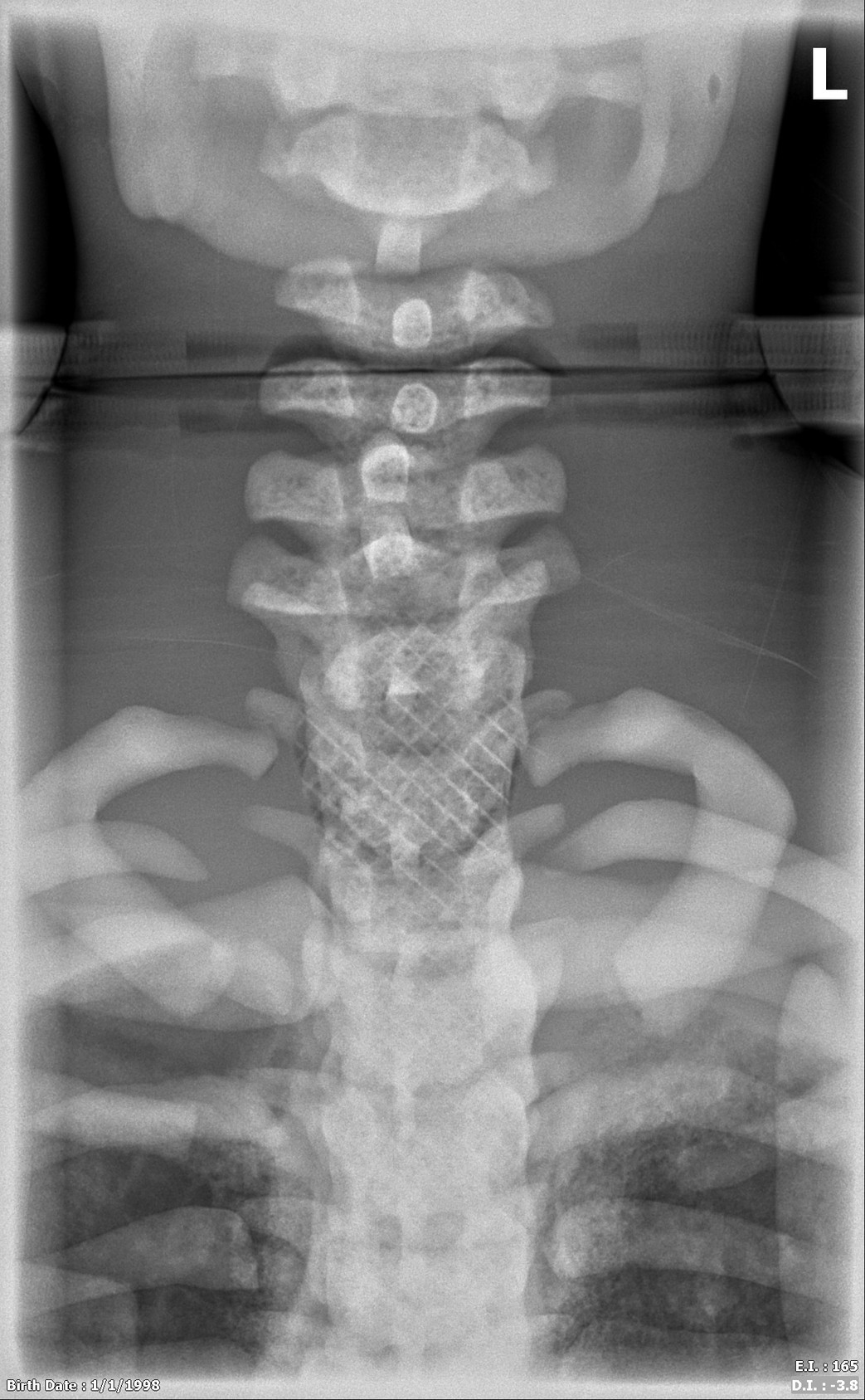 Adult Male Full Body X-Ray/CT and MRI Phantom Model - X-Ray scans