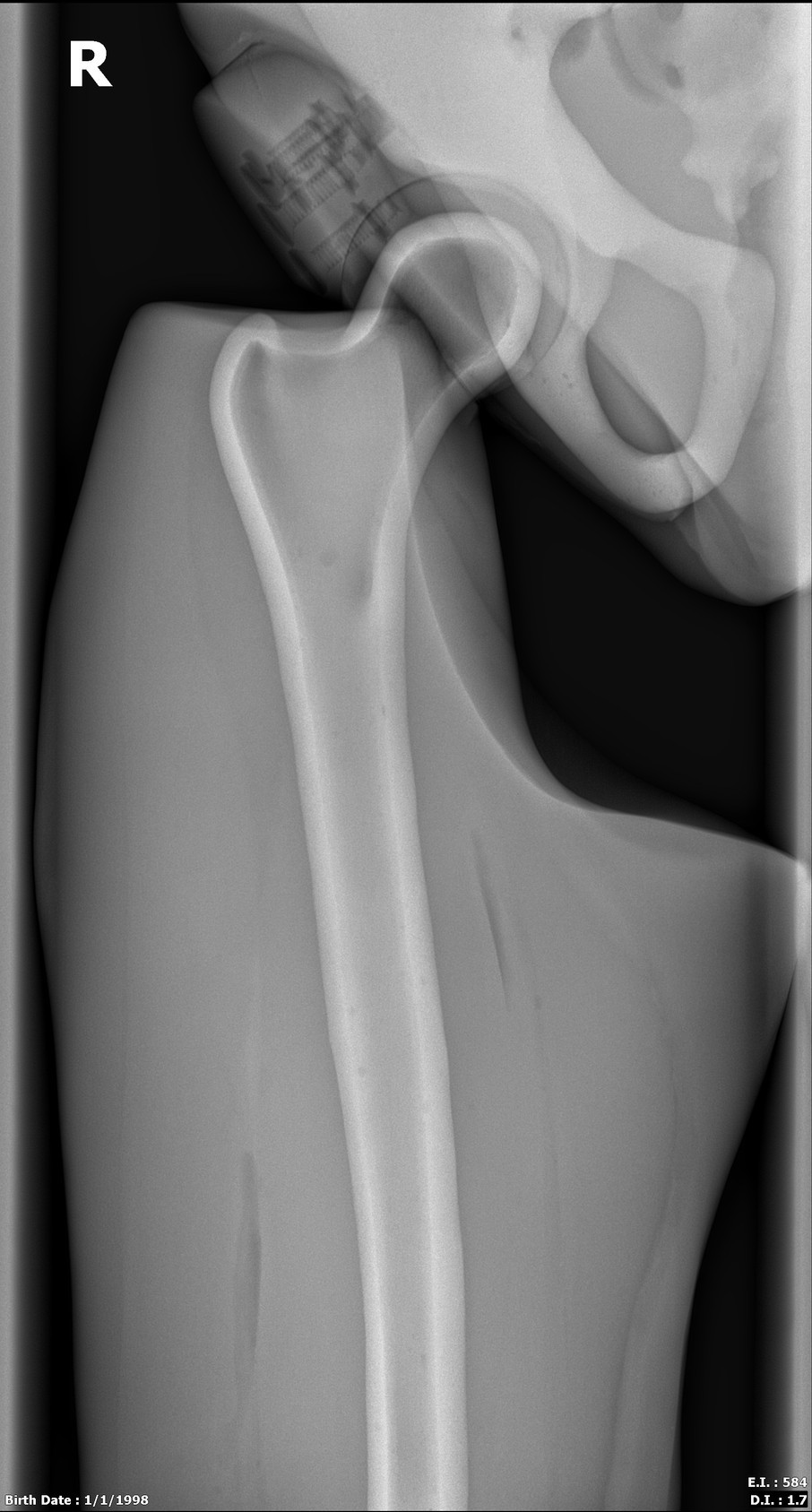 Adult Male Full Body X-Ray/CT and MRI Phantom Model - X-Ray scans