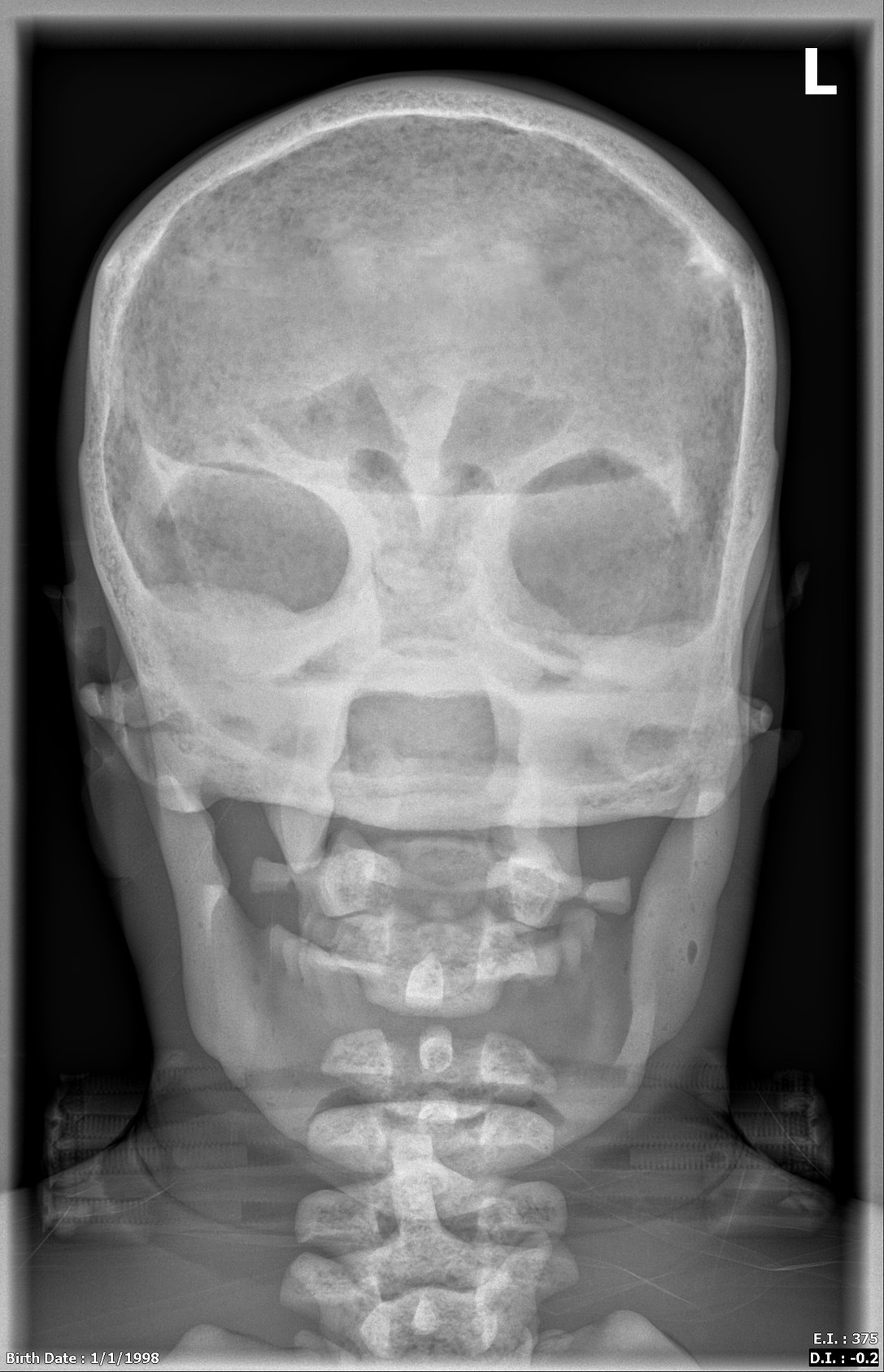 Adult Male Full Body X-Ray/CT and MRI Phantom Model - X-Ray scans