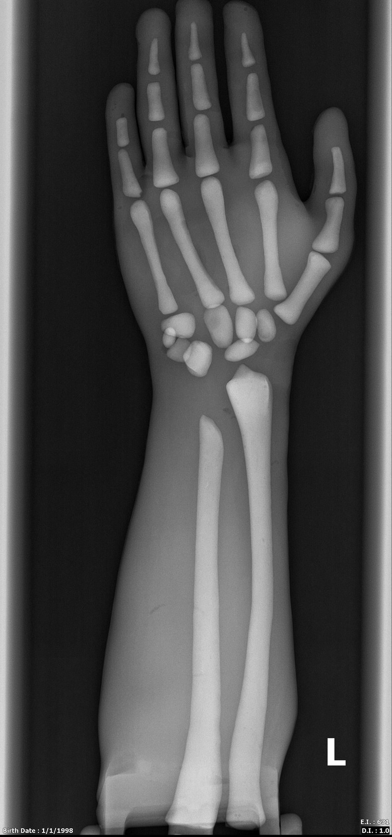 Adult Male Full Body X-Ray/CT and MRI Phantom Model - X-Ray scans