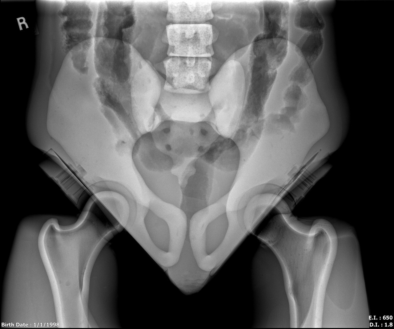 Adult Male Full Body X-Ray/CT and MRI Phantom Model - X-Ray scans