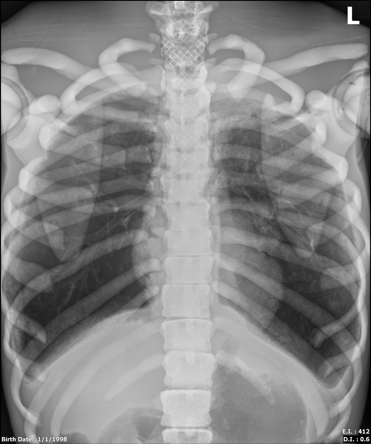 Adult Male Full Body X-Ray/CT and MRI Phantom Model - X-Ray scans
