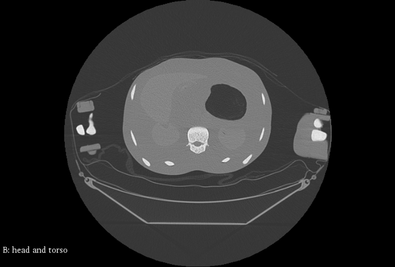Adult Male Full Body X-Ray/CT and MRI Phantom Model - CT scans