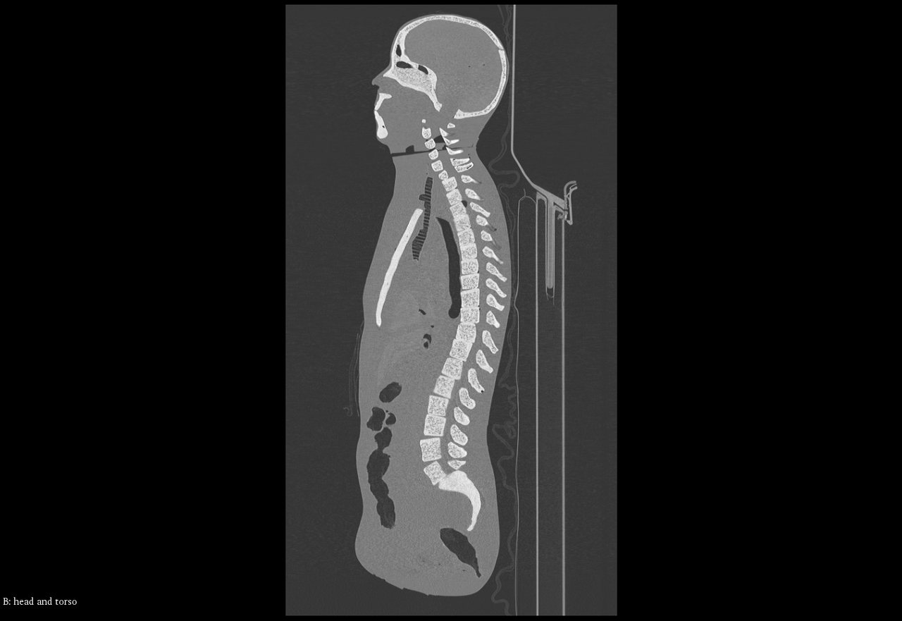 Adult Male Full Body X-Ray/CT and MRI Phantom Model - CT scans