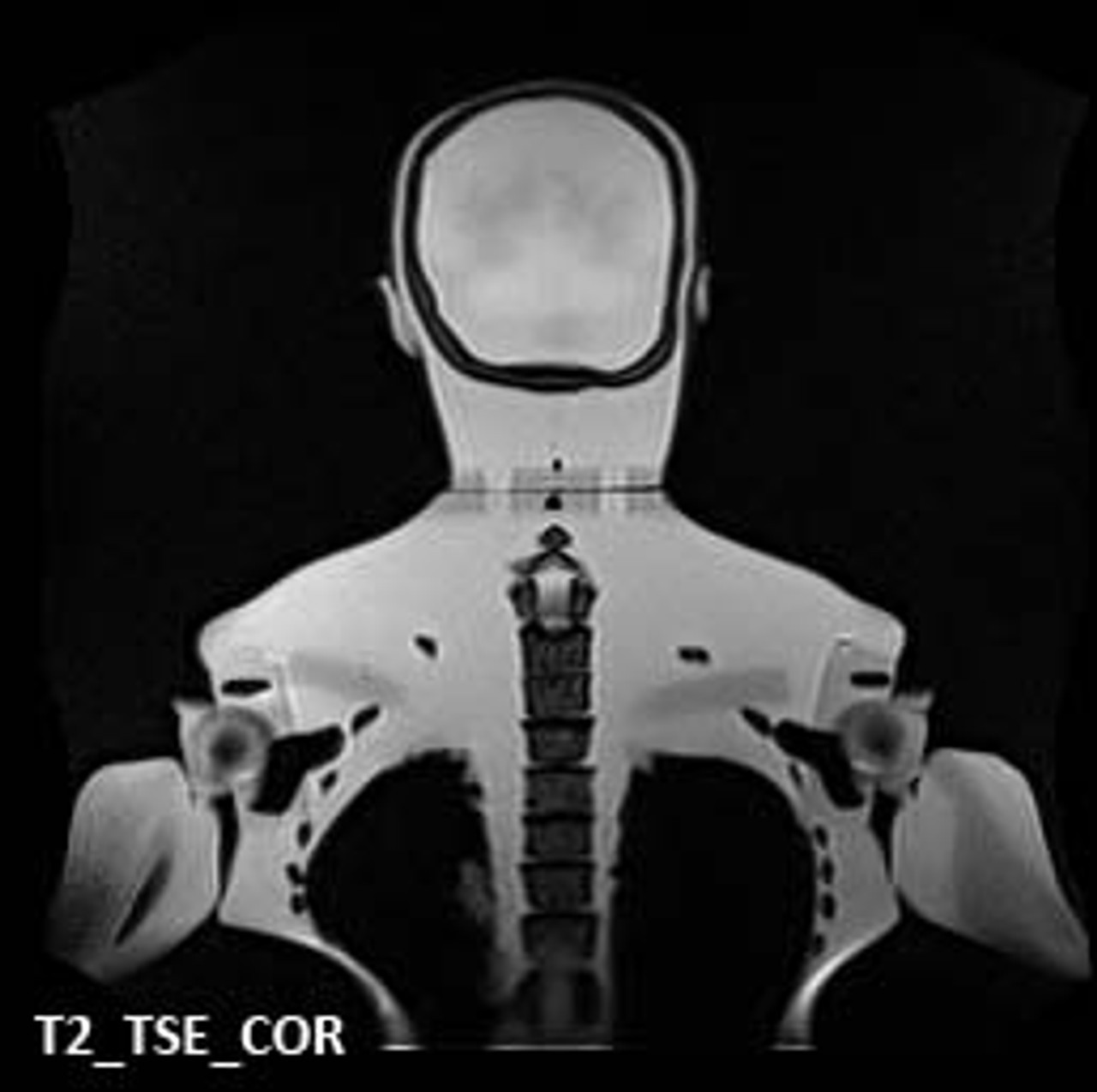 Adult Male Full Body X-Ray/CT and MRI Phantom Model - MRI scans
