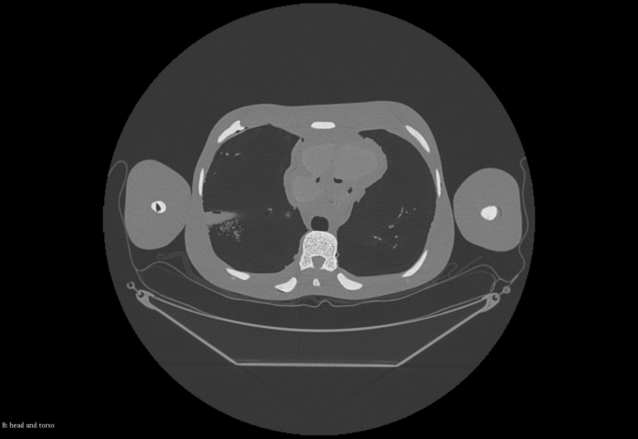 Adult Male Full Body X-Ray/CT and MRI Phantom Model - CT scans