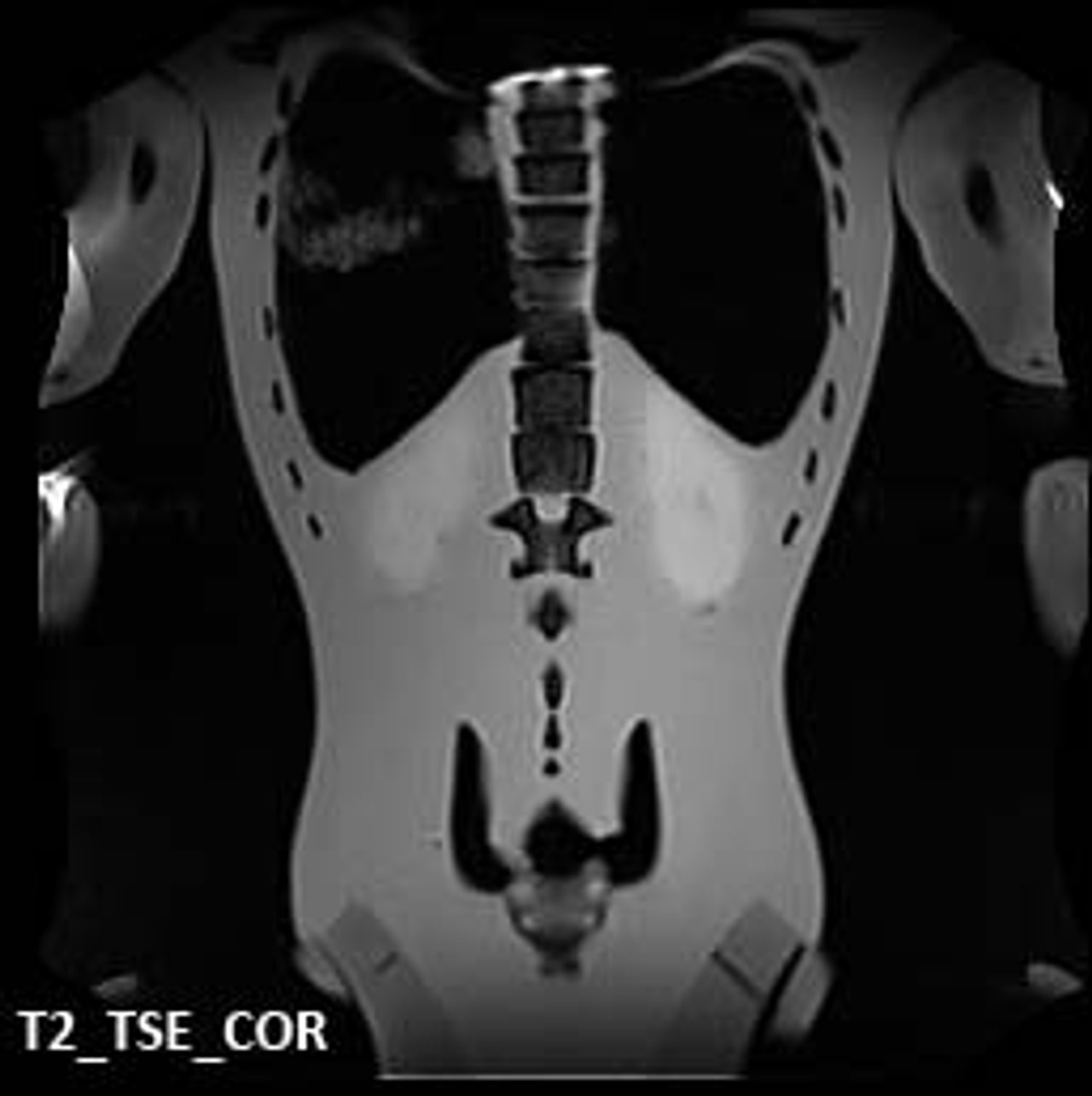 Adult Male Full Body X-Ray/CT and MRI Phantom Model - MRI scans