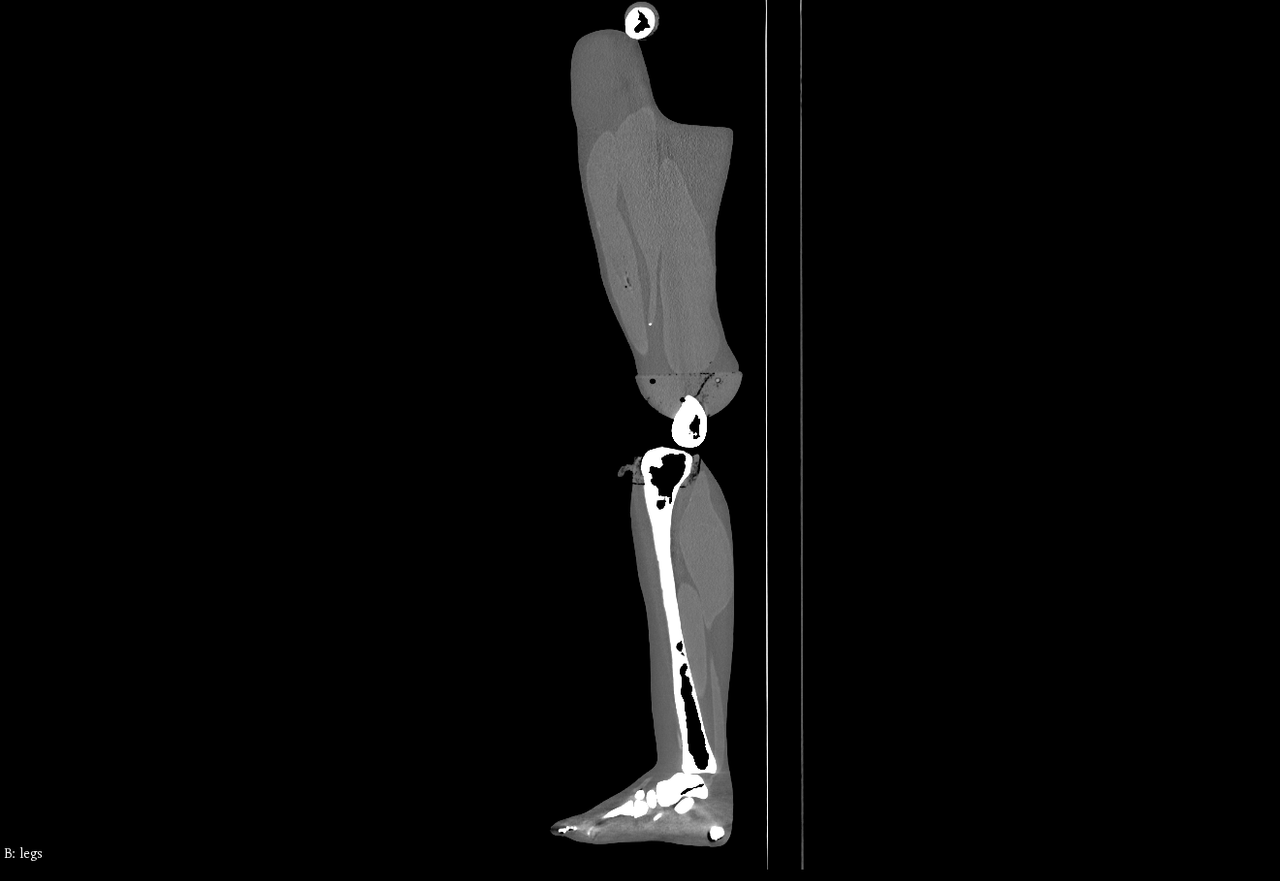 Adult Male Full Body X-Ray/CT and MRI Phantom Model - CT scans