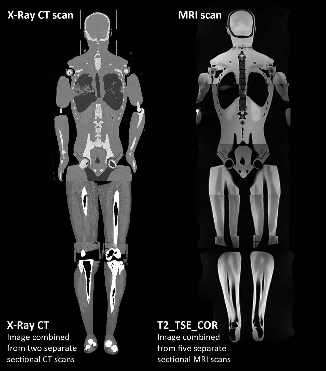 Adult Male Full Body with Muscles X-Ray/CT and MRI Phantom Model