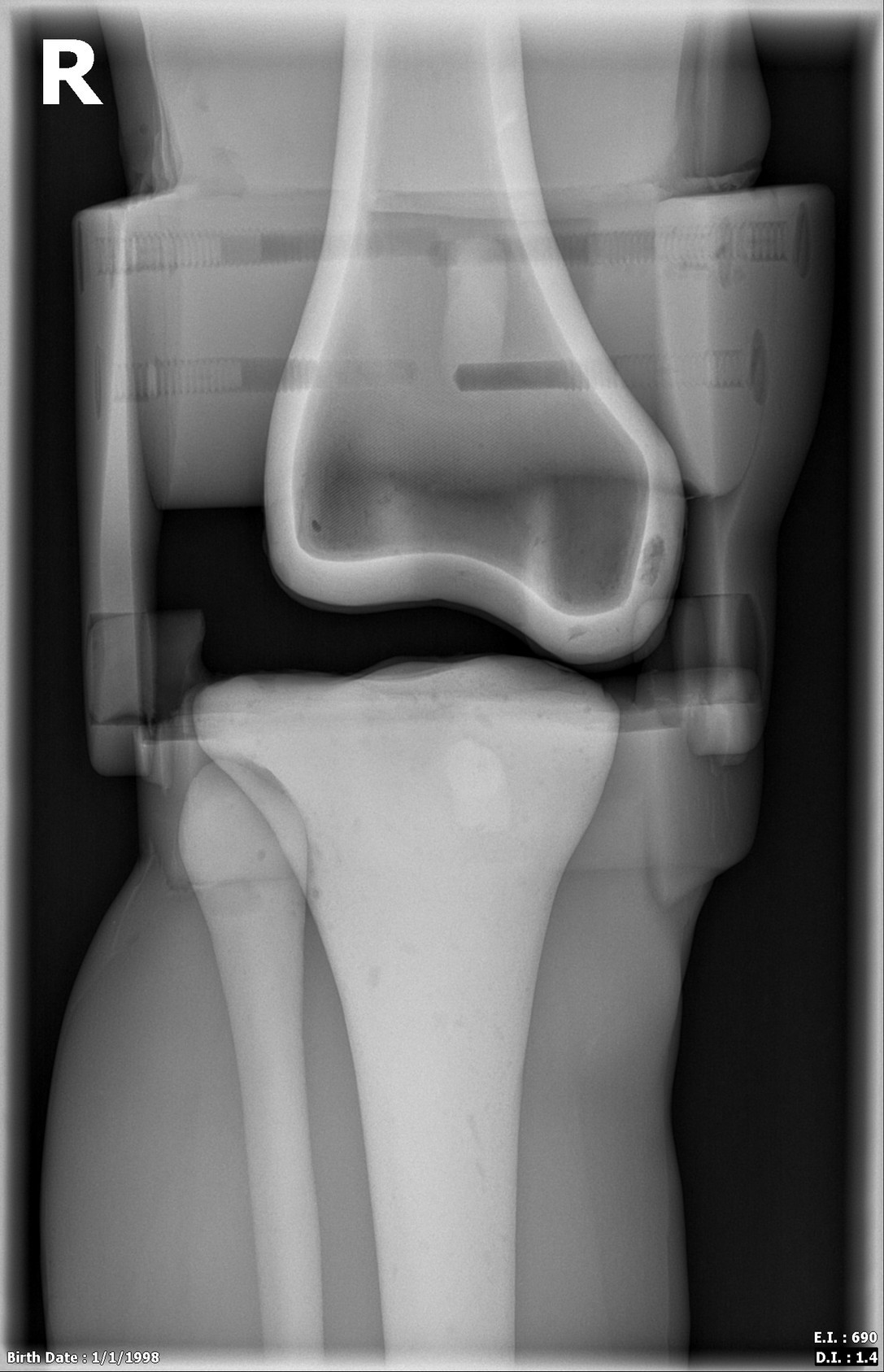 Adult Male Full Body with Muscles X-Ray/CT and MRI Phantom Model