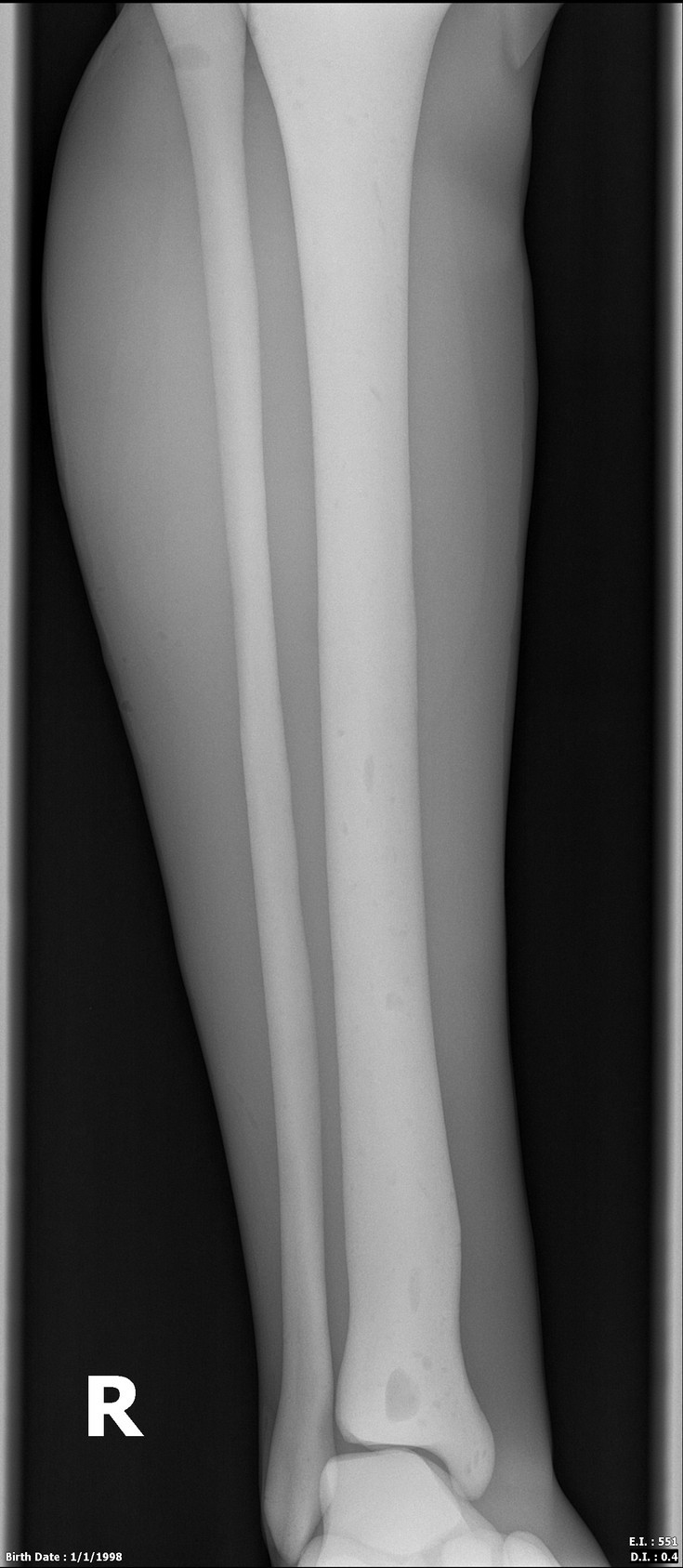Adult Male Full Body with Muscles X-Ray/CT and MRI Phantom Model