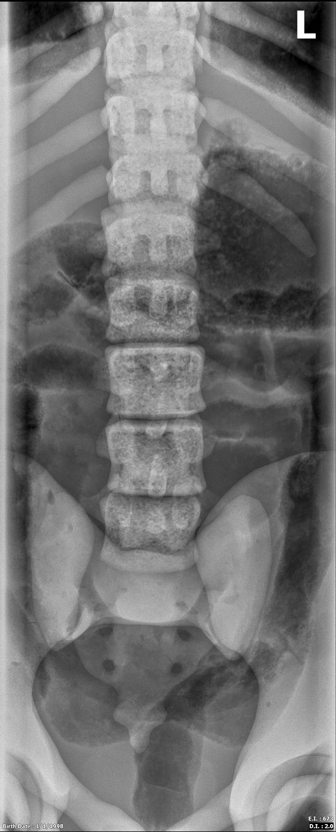 Adult Male Full Body with Muscles X-Ray/CT and MRI Phantom Model