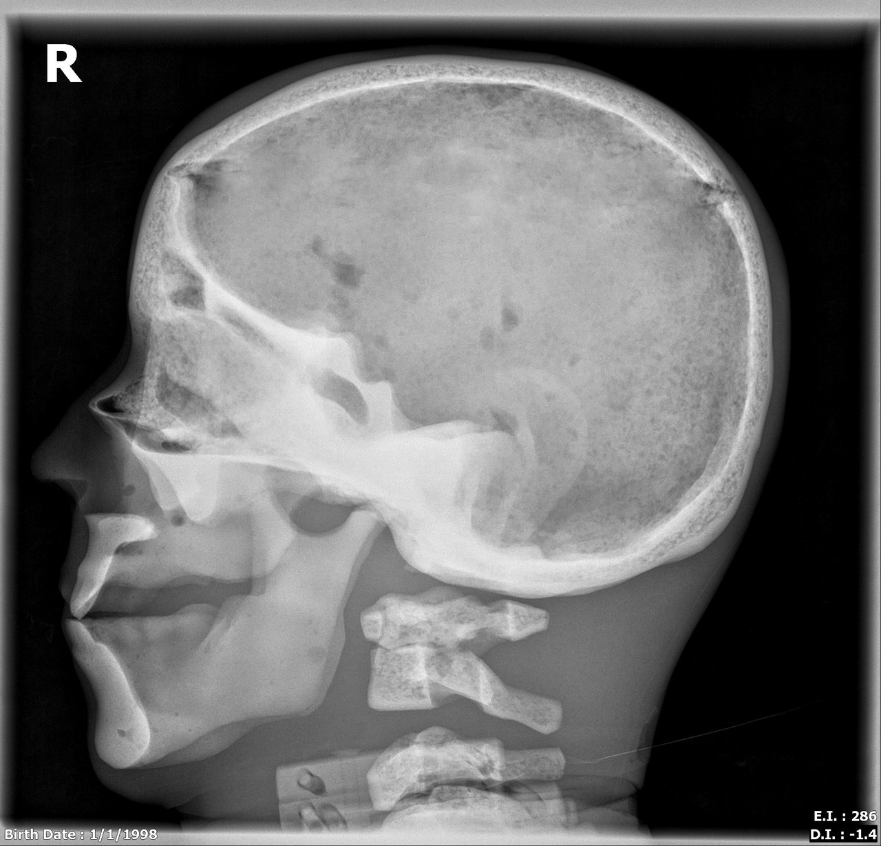 Adult Male Full Body with Muscles X-Ray/CT and MRI Phantom Model