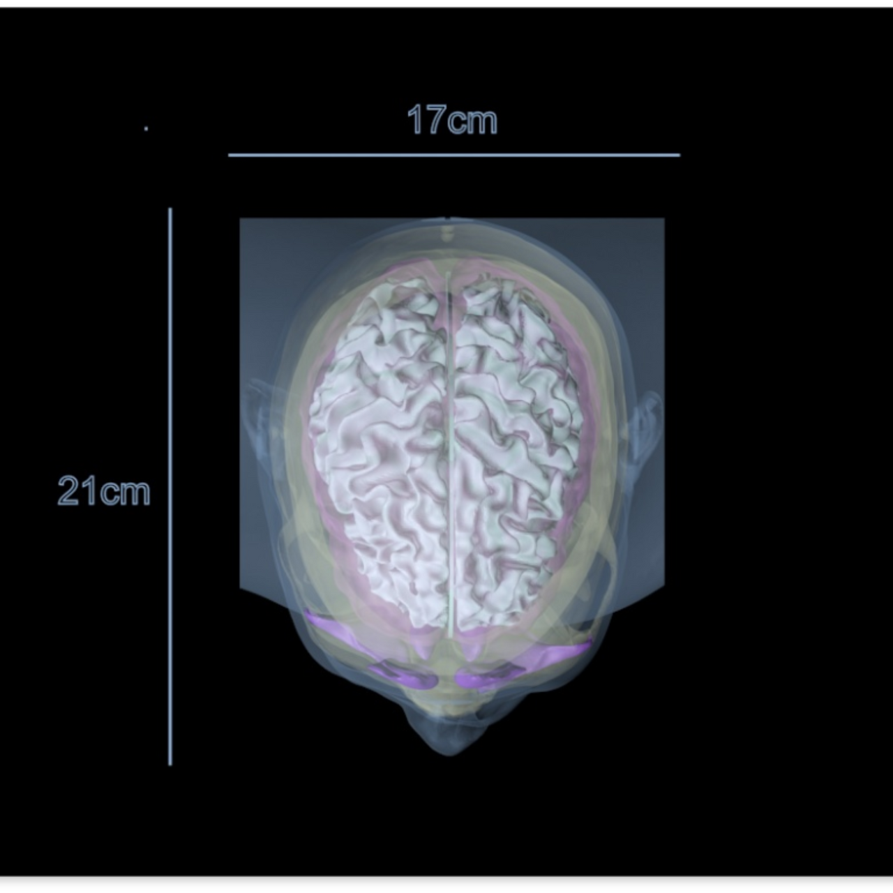 Adult Head X-Ray/CT and MRI Training Phantom Model