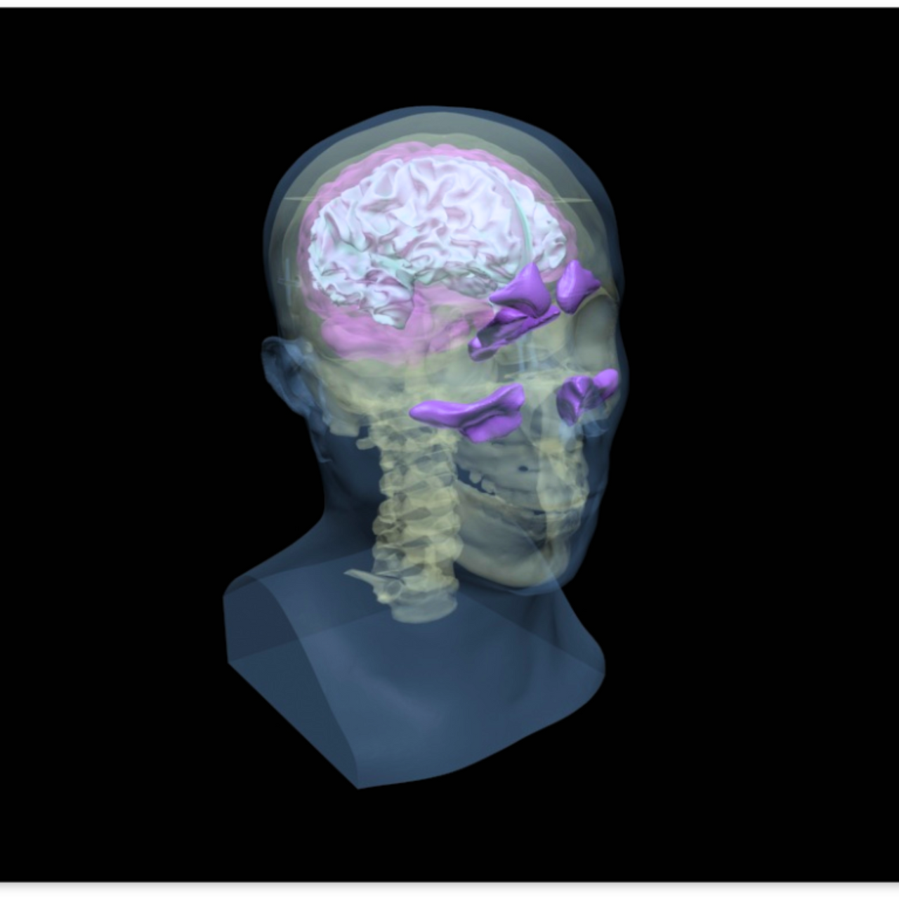 Adult Head X-Ray/CT and MRI Training Phantom Model