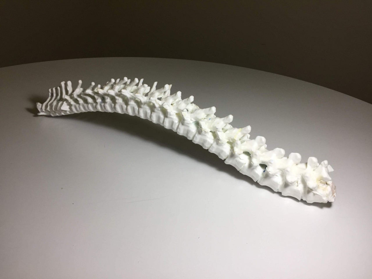 Adult Female Torso for X-Ray CT, MRI