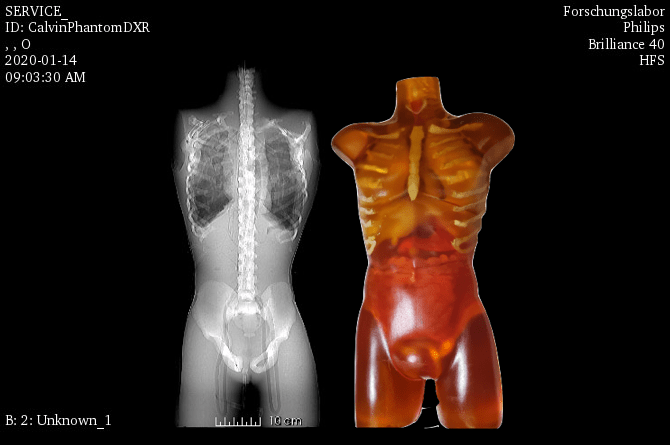Adult Female Torso for X-Ray CT, MRI