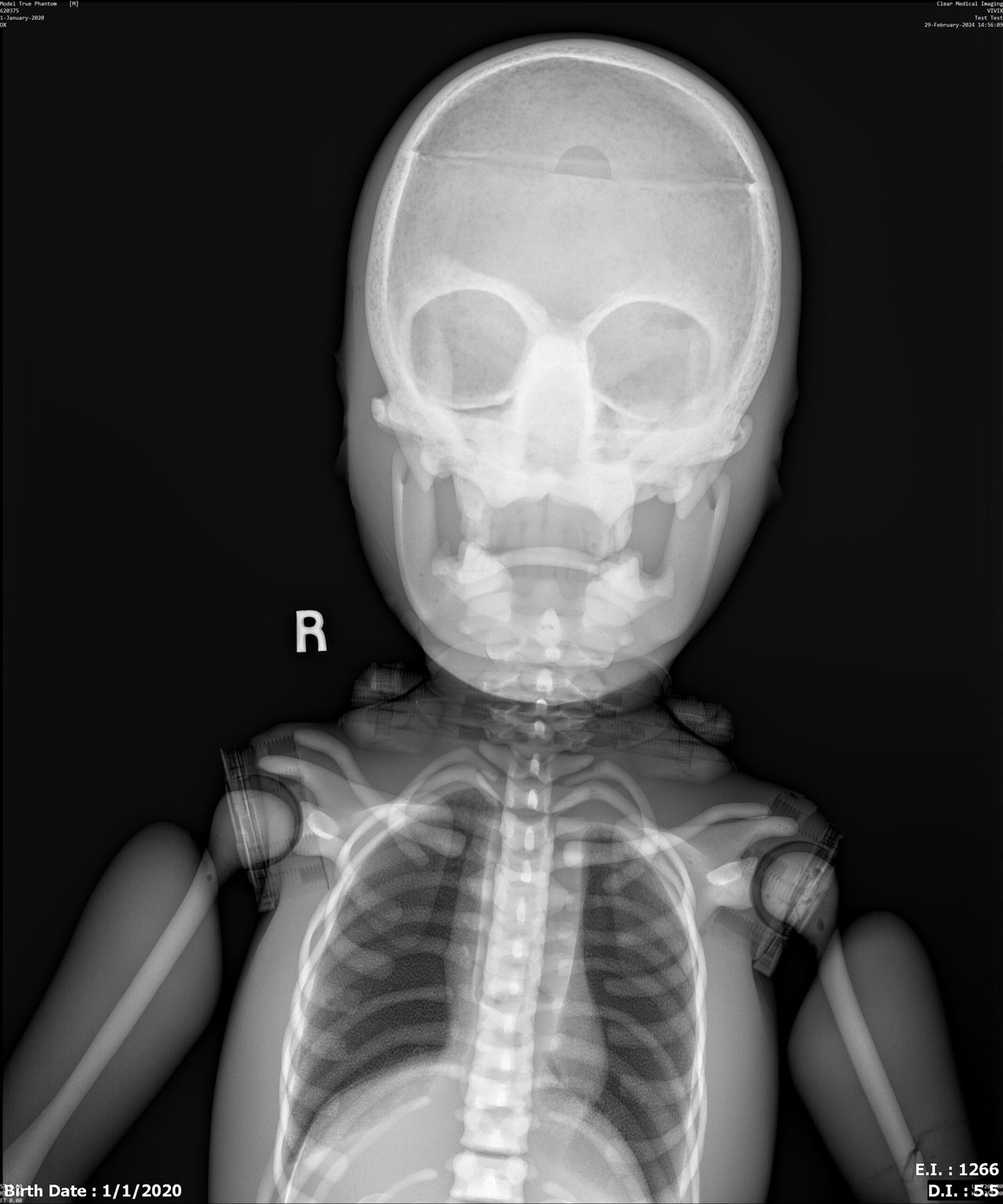 Pediatric 4-Year Old Full Body Phantom Model with Carry Case - X-Ray scans