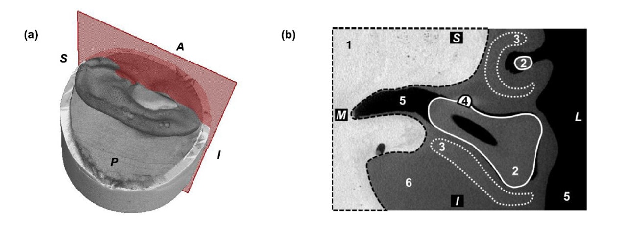 Adult Ear Phantom Model - CT scans