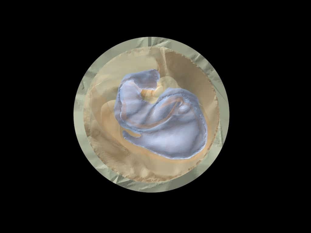 Adult Ear Phantom Model