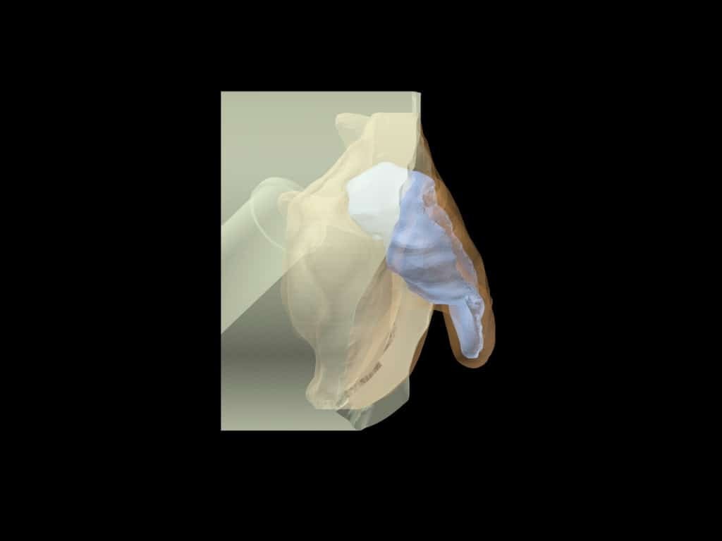 Adult Ear Phantom Model