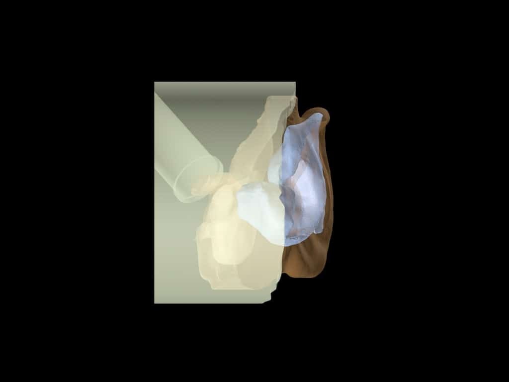 Adult Ear Phantom Model