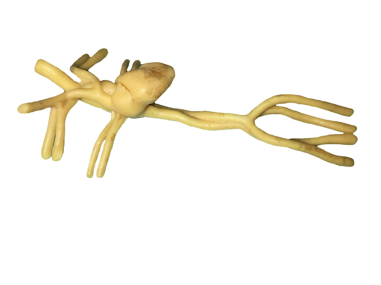Adult Heart Phantom Model