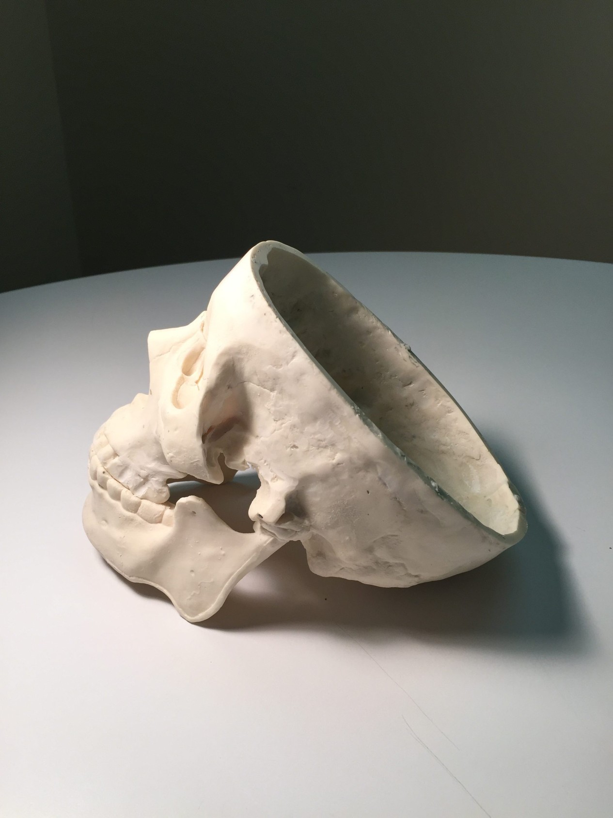 Adult Male Skull Phantom
