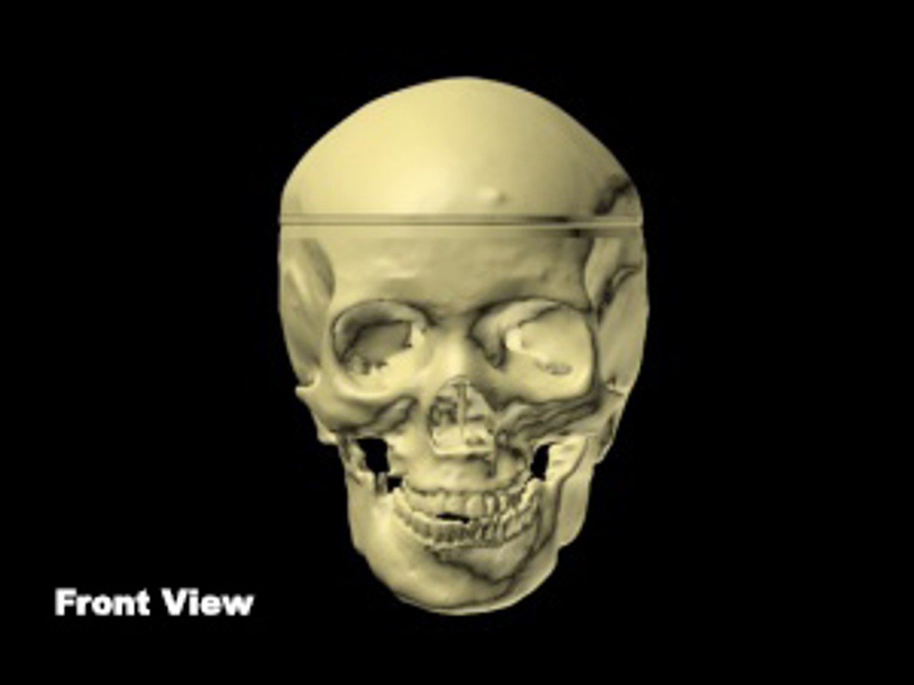 True Phantom Adult Male Skull Phantom | Anatomy Warehouse