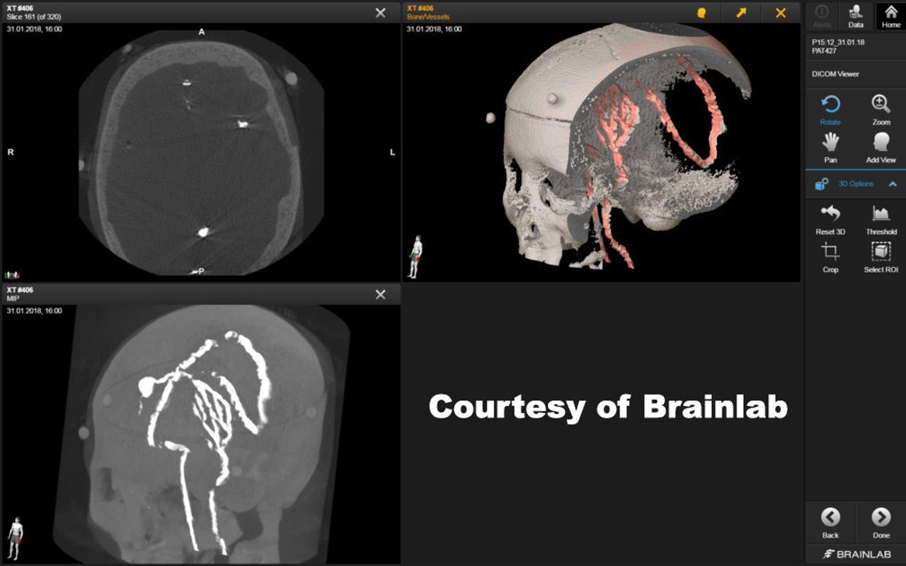 True Phantom Adult Male Skull Phantom | Anatomy Warehouse